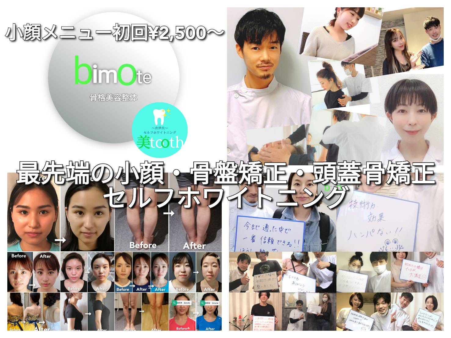 次世代セルフホワイトニング 美toothセルフホワイトニングのお客様の声5