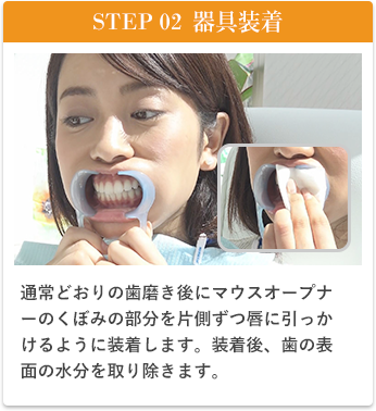 STEP02器具装着、通常通りの歯磨き後にマウスオープナーのくぼみの部分を片側ずつ唇に引っ掛けるように装着します。装着後、歯の表面の水分を取り除きます。